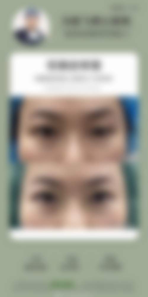 【哈尔滨诺嬄美整形美容医院参考价格表:】