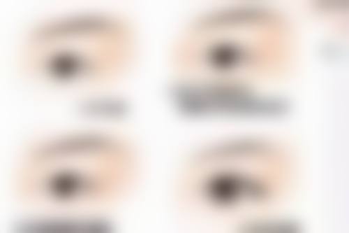 打除皱针怎么能快速代谢掉