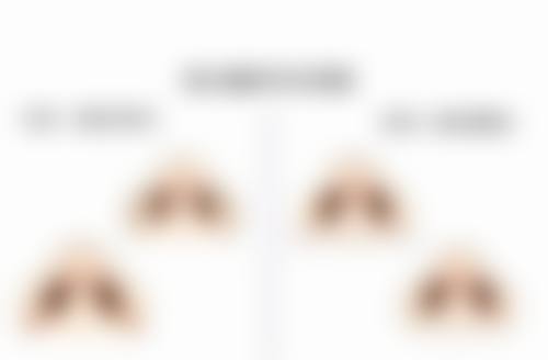阴式子宫切除 + 阴道前后壁修补术的修复与同房时间