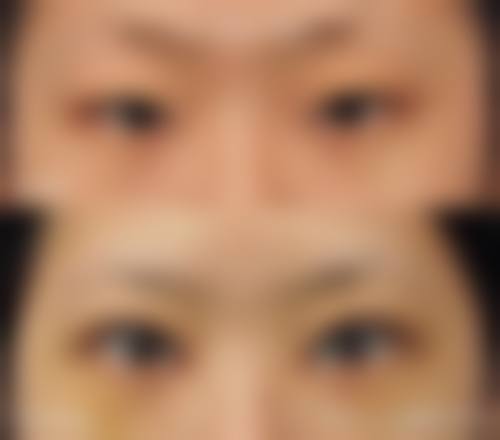 天津紫洁医美眼&面部年轻化价格 6800 元起项目的口碑