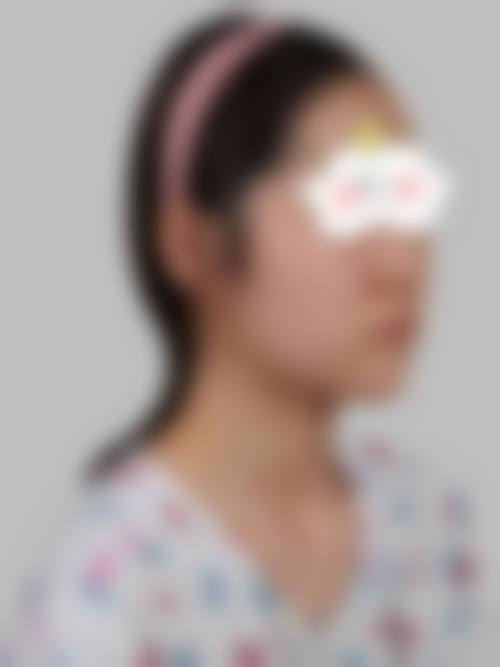 【李昌医生擅长项目:】