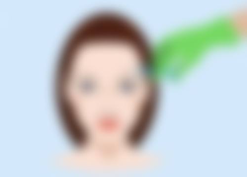 面部美白针是在脸部打针吗