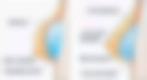 全身美白针的副作用和有危险吗