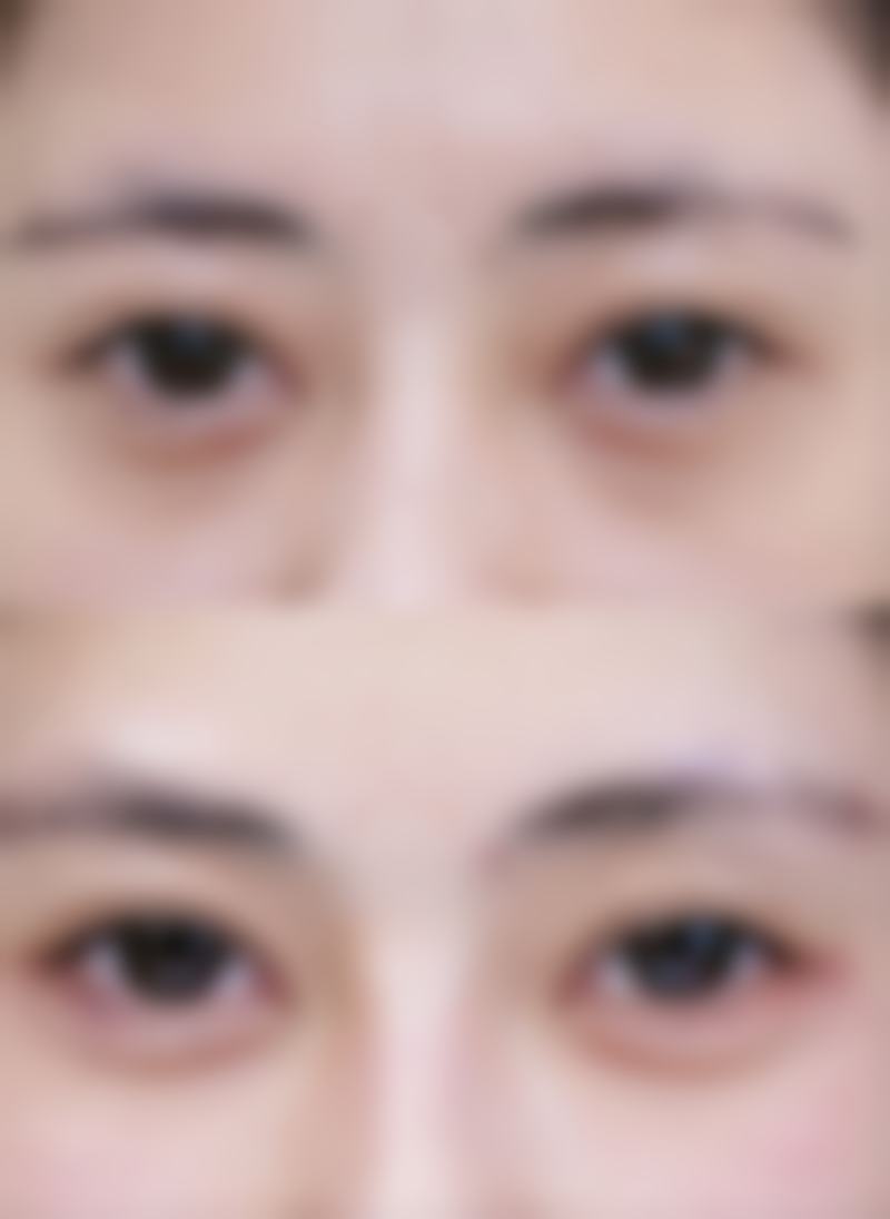【重庆潘多拉医疗美容诊所参考价格表:】