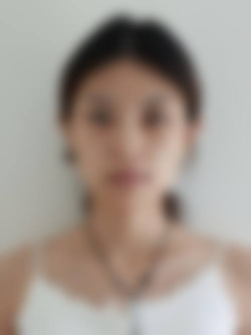 医院配备了精良的整形美容设备，其中有高清晰度的内窥镜和激光设备等。高清晰度的内窥镜就像是医生的“超级眼睛”，在手术过程中，医生可以通过它清晰地看到身体内部的情况，这样就能更精细地进行操作，大大提高了手术的安心性和成功几率。而激光设备在皮肤美容等项目中发挥着重要作用，它可以针对不同的皮肤问题，如色斑、皱纹等，进行有效的治疗，而且治疗成效显著，对皮肤的损伤也比较小。