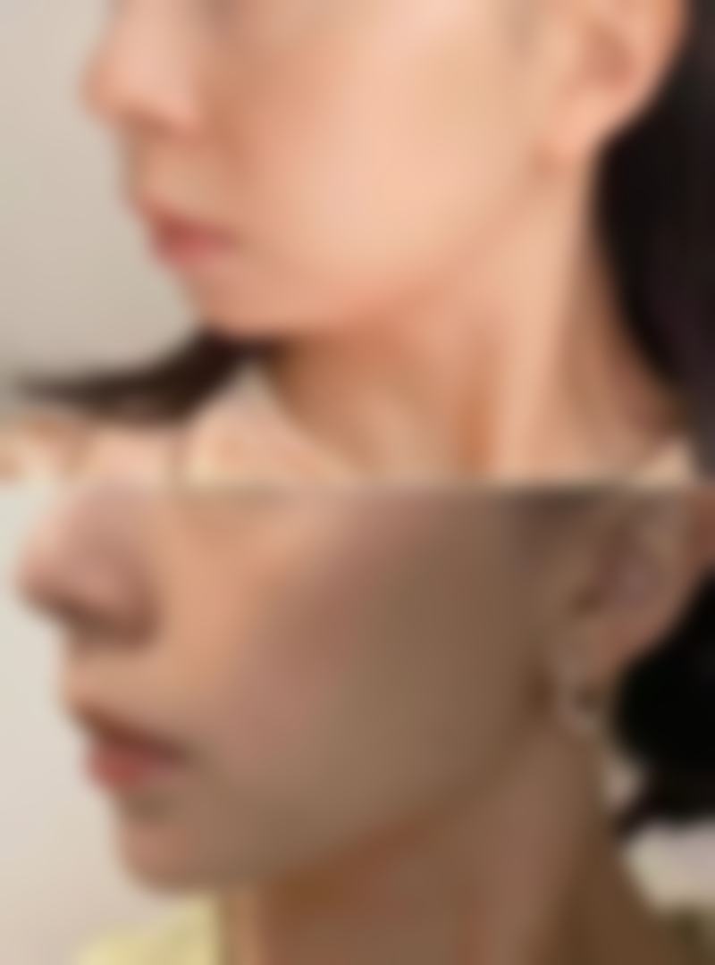 【兰州中泰整形医院诊疗设备：】