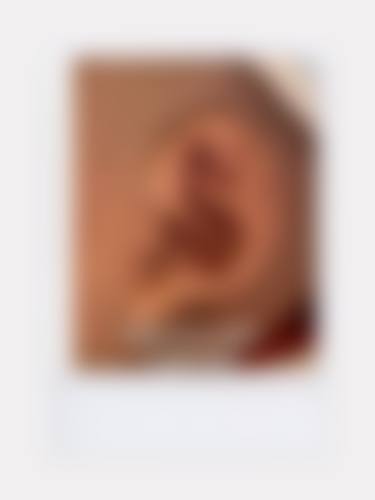 【杭州橙匠阿尔法医疗美容门诊部是正规的吗?】