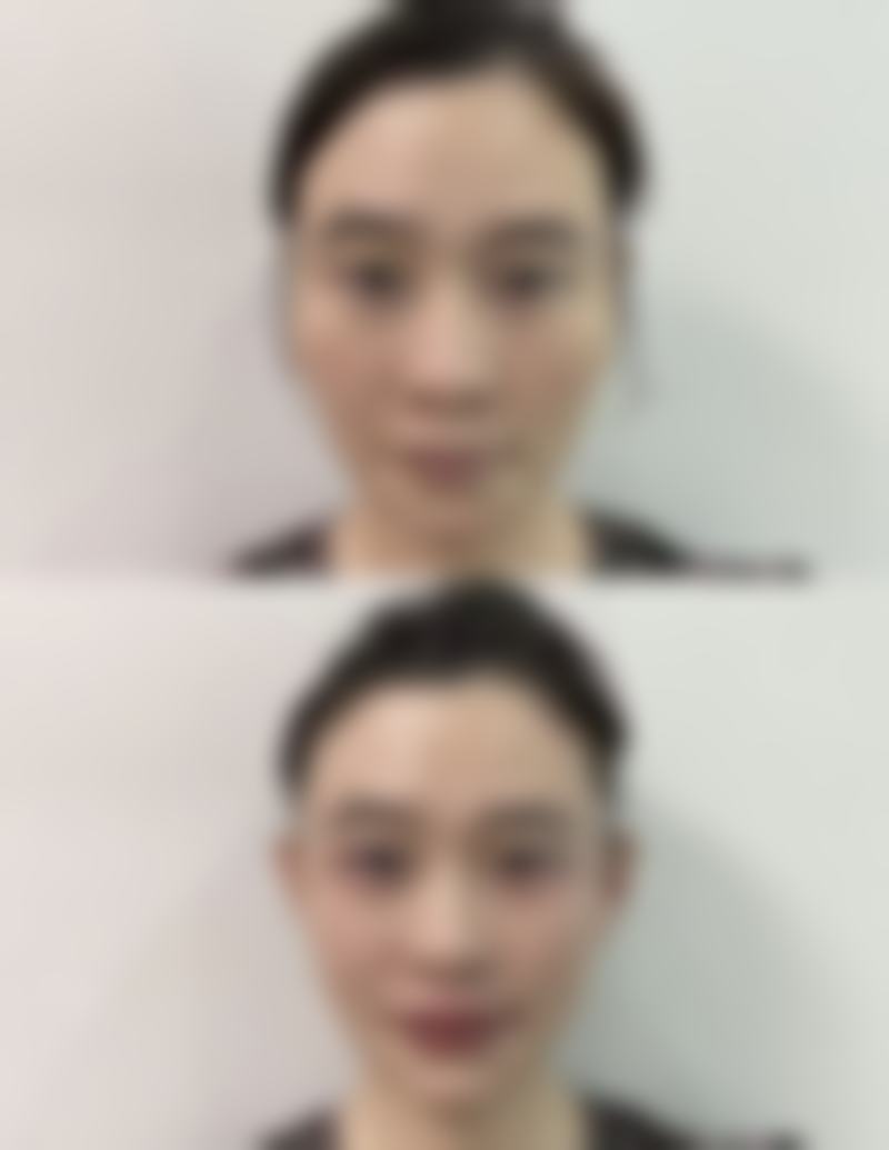 【广西中 医 药大学附属瑞康医院整形美容中 心是正规的吗?】