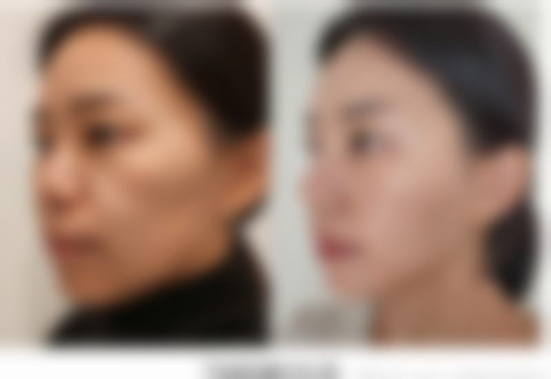 【长春尚氏华医整形门诊部是正规的吗?】