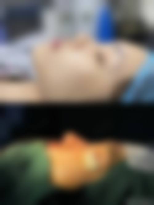 【陈泽医生技术特点:】