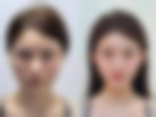 【西安未央鼎欣晟唐医疗美容患者口碑评价:】