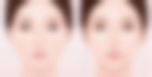 割掉包皮要多少钱