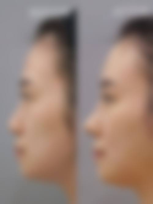 结尾预约号召