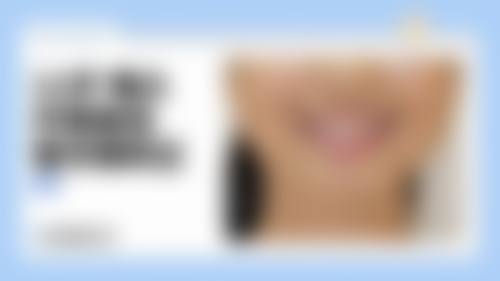 患者真实评价北京泰康拜博口腔医院东城口腔门诊部任世超