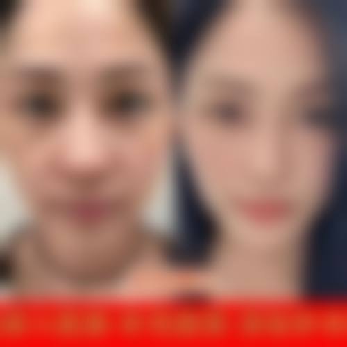 双院长领衔:金太焕与金善球的技术详解