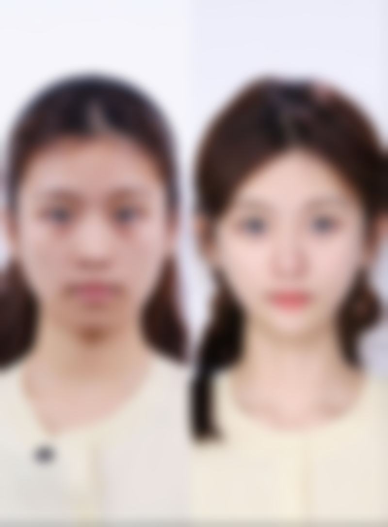 【福州迪娅医疗美容门诊部患者口碑评价：】