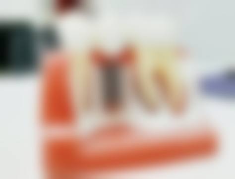临床实例分享:能达到一样的成效吗?