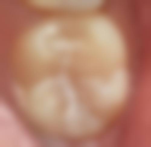 擅长项目详解:适合我的牙齿情况吗?