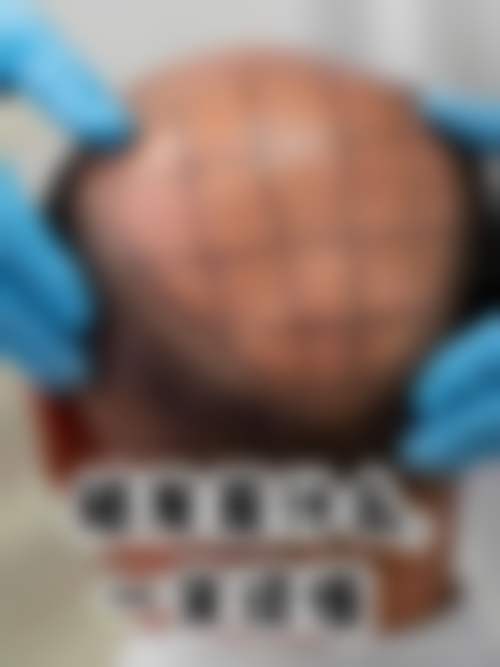 擅长项目详解:张选奋医生的核心技术优势