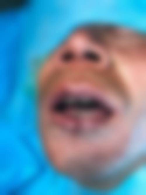 FAQ:佳木斯美白医疗美容医院姚颖常见问题
