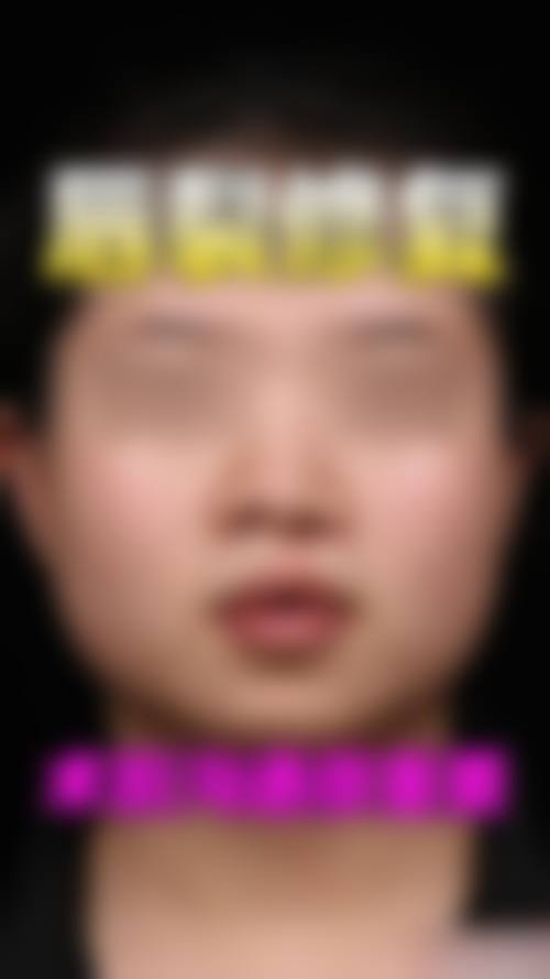 患者真实评价:佳木斯美白医疗美容医院姚颖