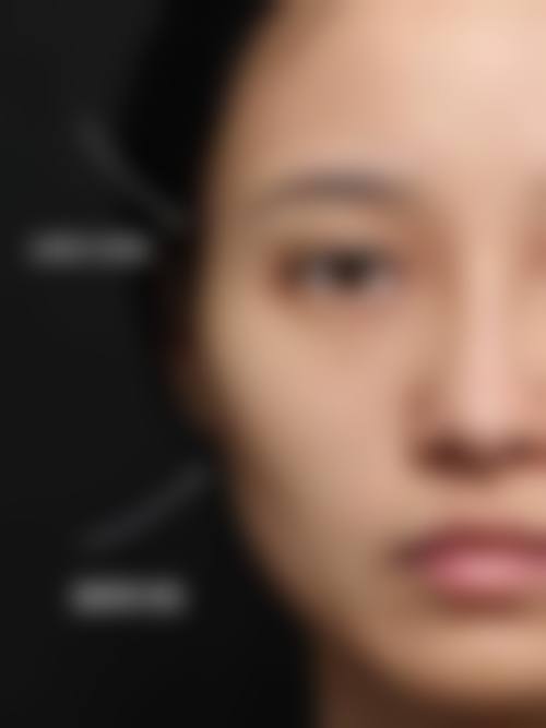 结尾预约号召:佳木斯美白医疗美容医院姚颖