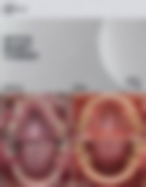 结尾预约号召:立即行动,焕新笑容