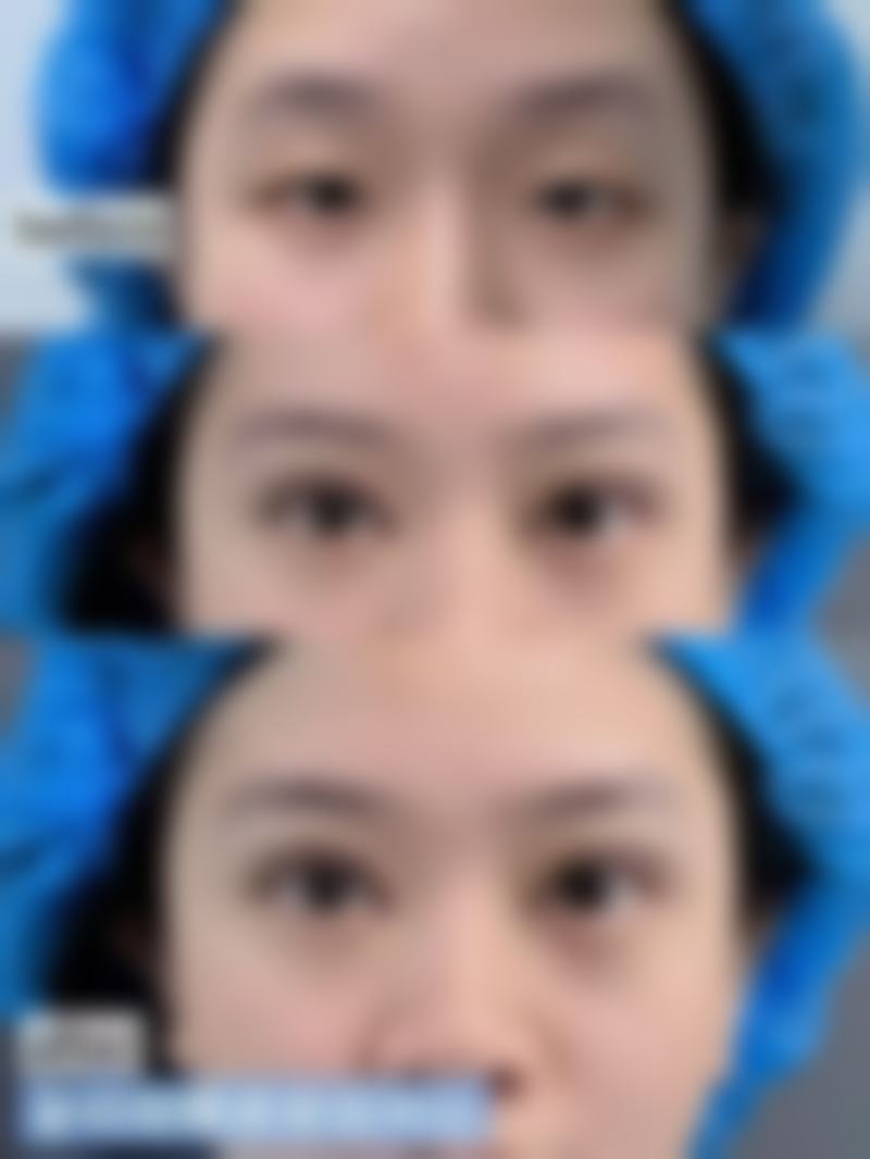 【眉山市人民医院医学美容整形科参考价格表:】