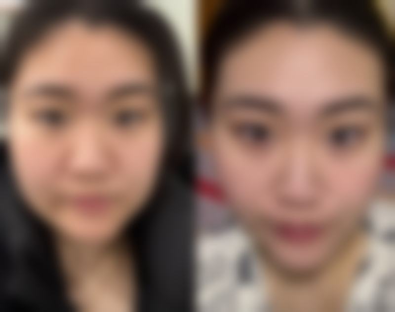 【鲍广志医生擅长项目:】