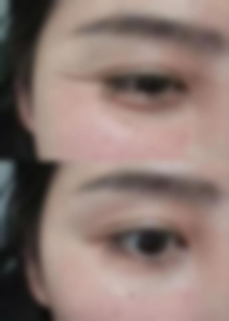 【兴安盟缔十三梵玛西整形医院是正规的吗?】