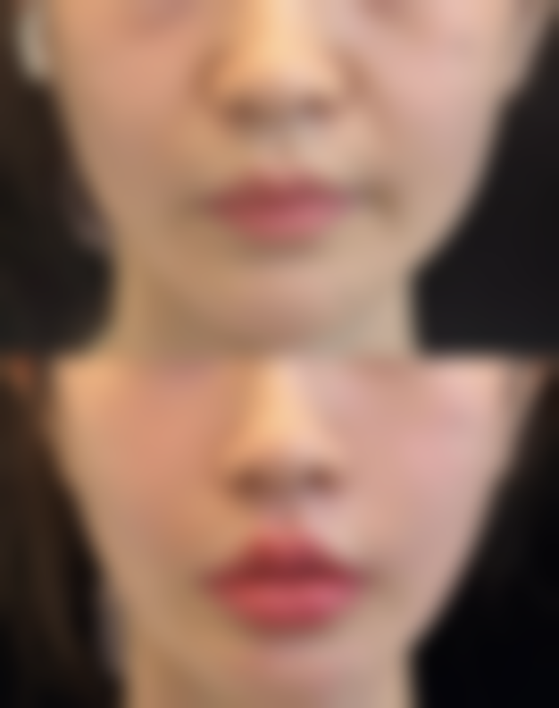 【信阳美丽之星医疗美容门诊部参考价格表:】