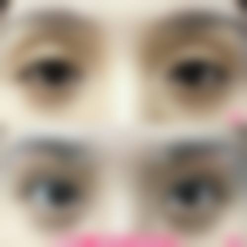 【沭阳微悦医疗美容诊所是正规的吗?】