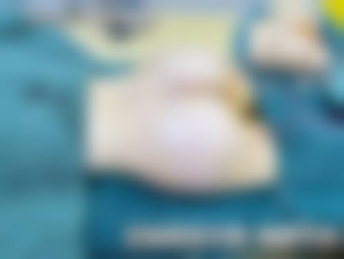 临床实例分享