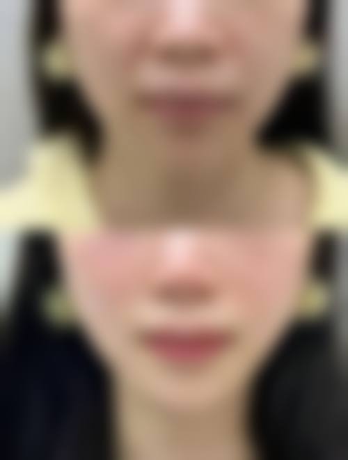 预约优惠活动:北京邦定万泉医疗美容诊所张秋云