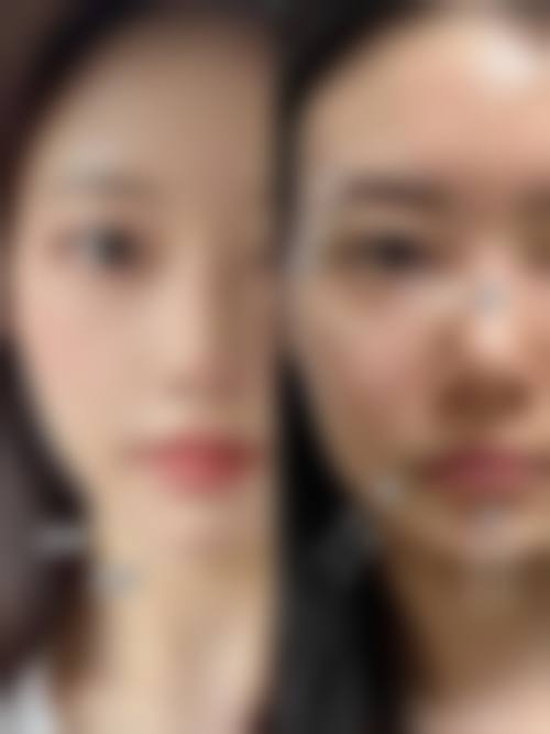 擅长项目详解:北京邦定万泉医疗美容诊所张秋云
