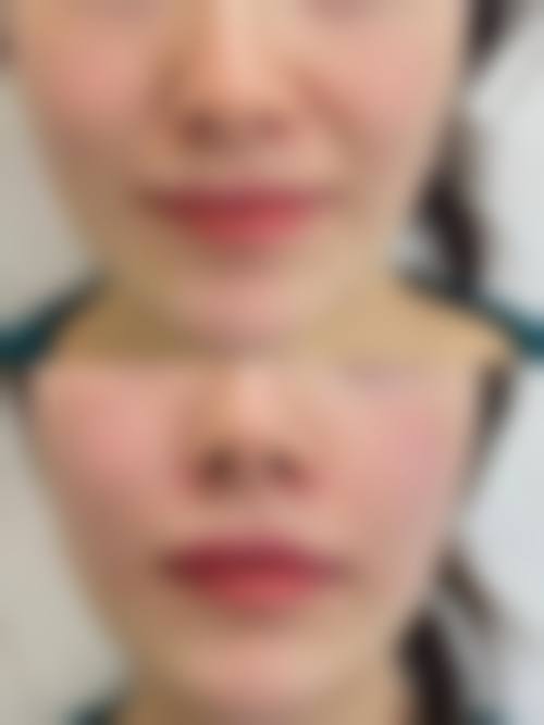 临床实例分享:真实改变看得见