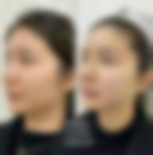 【沭阳微悦医疗美容诊所参考价格表：】