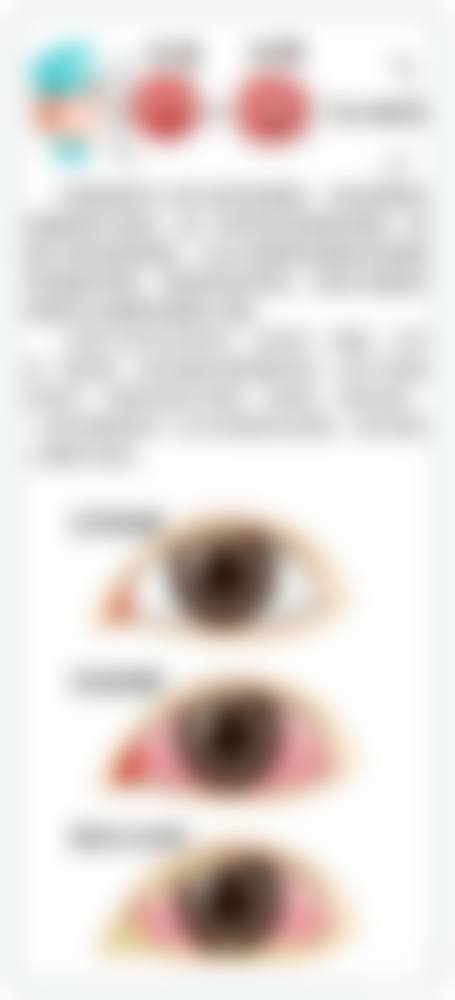 FAQ:关于石家庄市中医院眼科李恩的常见问题