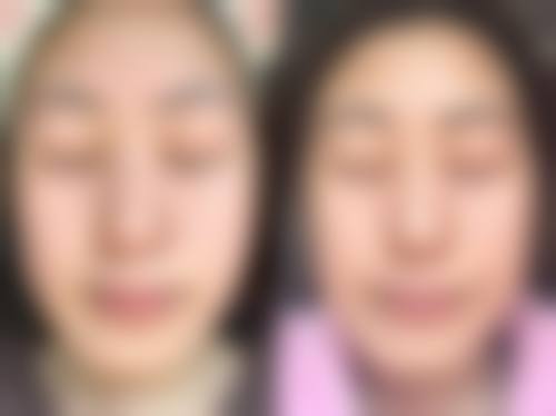 擅长项目详解