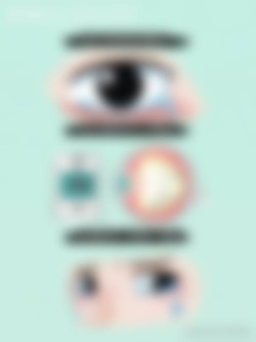FAQ:常见疑问解答