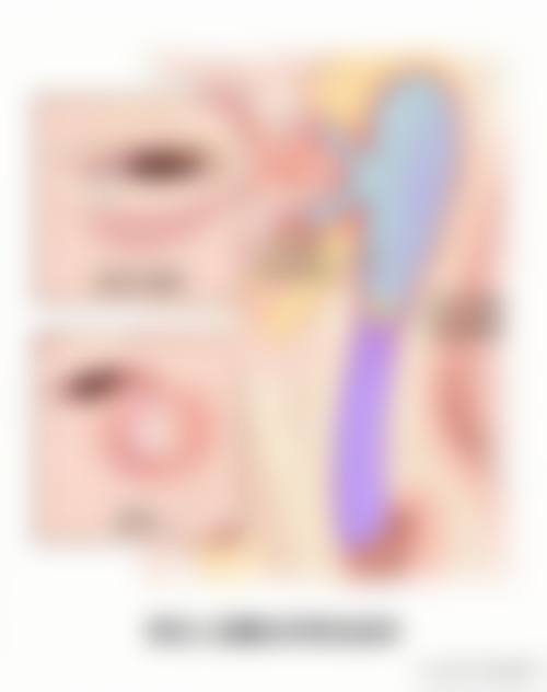临床实例分享