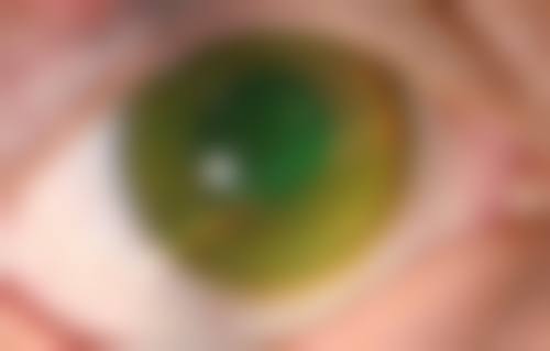 擅长项目详解:精细匹配眼部需求