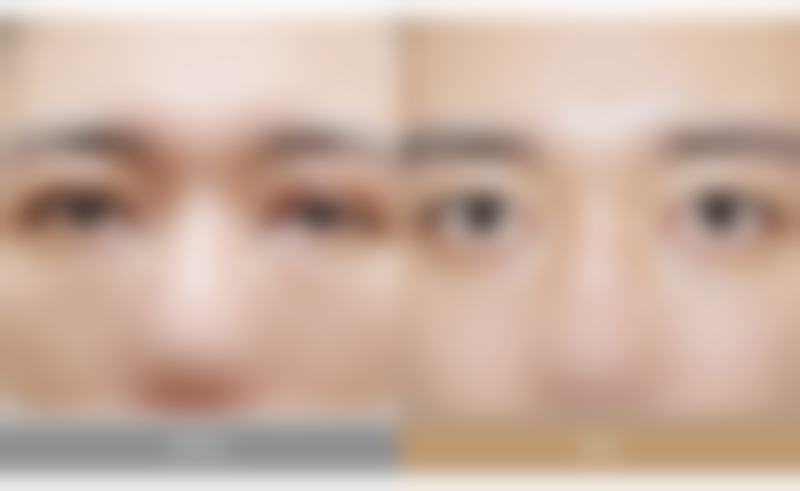 首尔特别市崔东一靠谱吗？资深医生亲述真实案例与价格明细，揭秘韩国整形界口碑真相