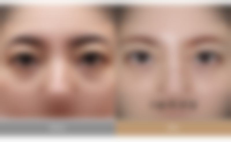 Jfeel Clinic桔艺菲皮肤科江南旗舰分院李容硕院长技术怎么样
