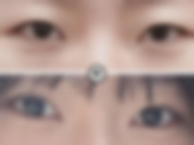 瘦脸针后忌口的东西都有啥