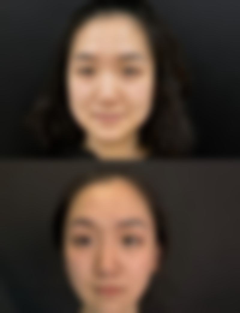 【Flex 皮肤科参考价格表：】