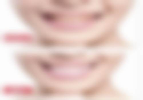 总结与预约号召