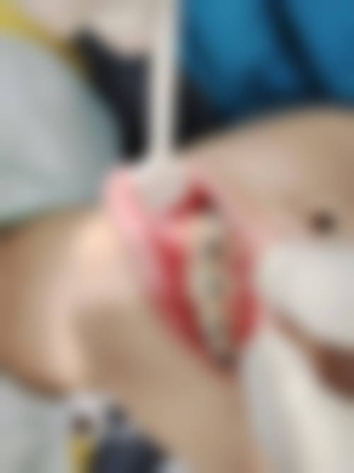 擅长项目详解