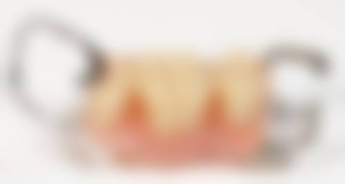 擅长项目详解