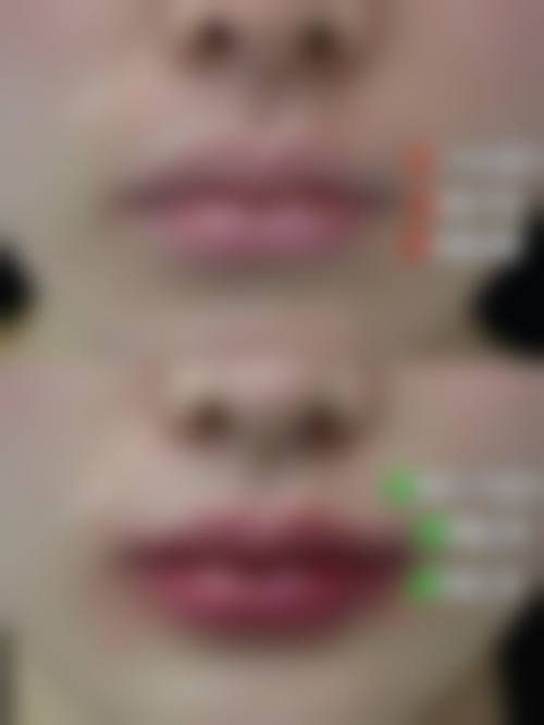结尾预约号召重庆潘多拉医疗美容诊所